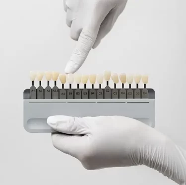 veneers near me in Plano, TX